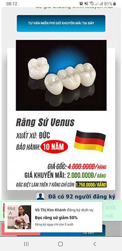 bọc sứ răng cấm bao nhiêu tiền
