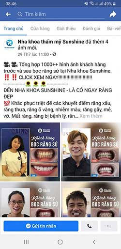 Bọc răng sứ trả góp ở Hà Nội