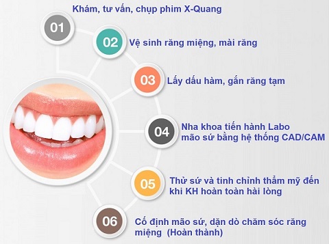 quy trình dán răng sứ thẩm mỹ