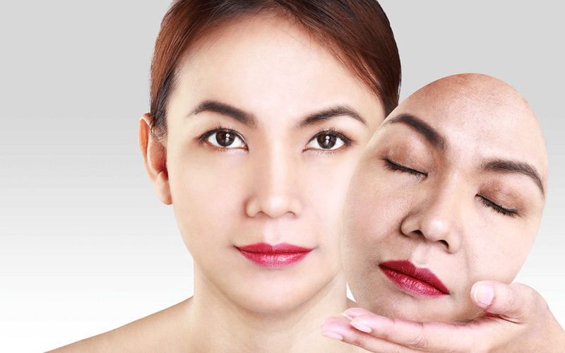 Căng da mặt bằng chỉ collagen là gì